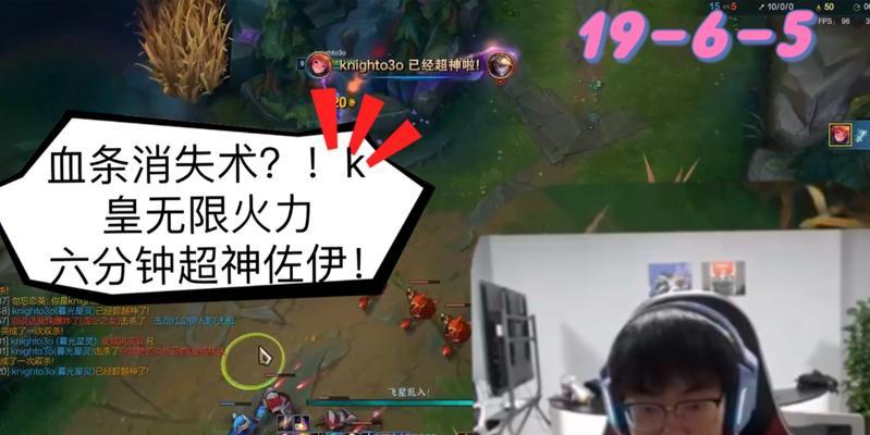 无限火力佐伊出装攻略（探索最新装备搭配，提升佐伊的输出能力）
